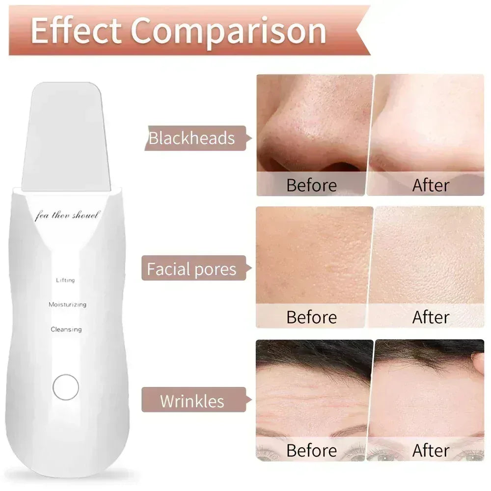 FawaQa | Leather Shovel Ultrasonic Facial Moisturizing Scrubber