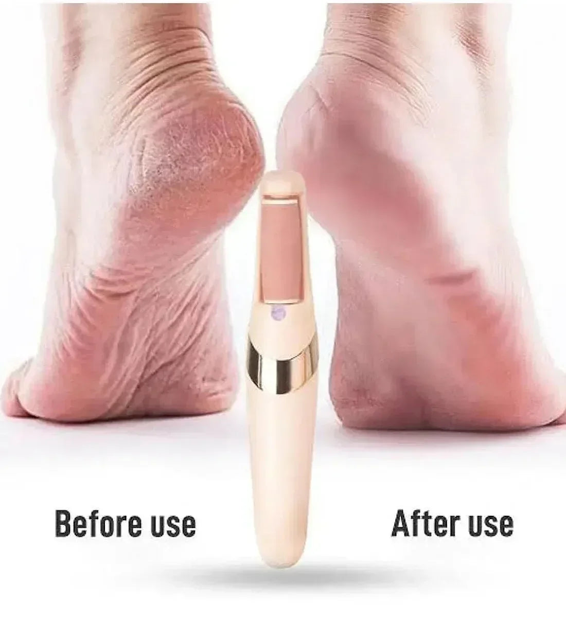 mudassir Cosmetics | WEIMEI Rechargeable Electric Foot File Callus Remover for Wet & Dry Pedicure